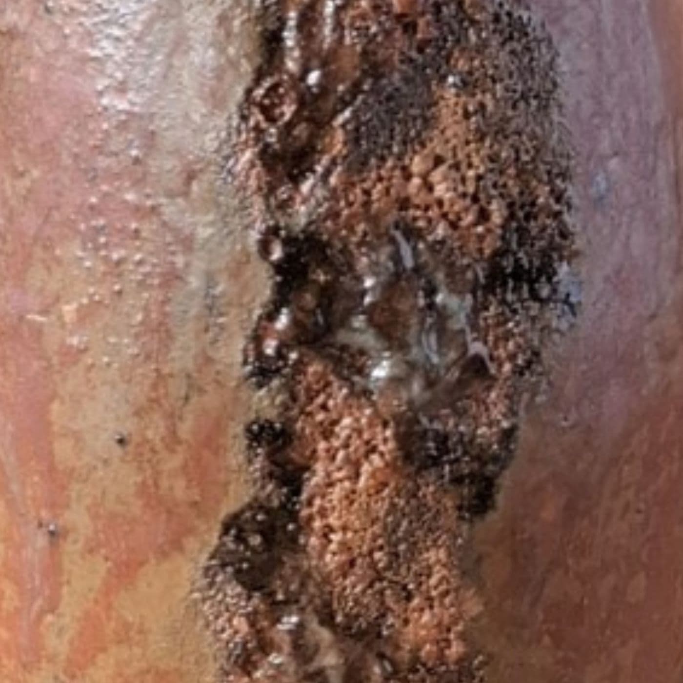 Corrosion Vessel